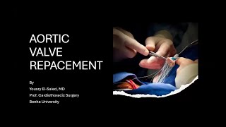 Aortic Valve Replacement Part 1 [upl. by Wynn339]