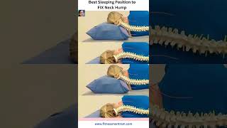 Best Sleeping Posture to fix Neck Hump Dowagers Hump neckpain fitnessmantram [upl. by Harriott]