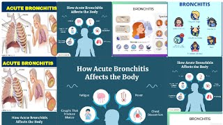 Health FlickAcute Bronchitis and new side effectsSymptomsCauses and more [upl. by Trout]