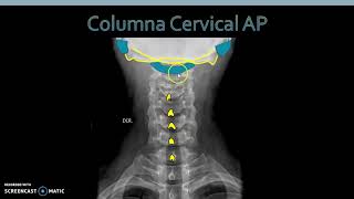 Anatomía Radiológica Columna Cervical [upl. by Cob]