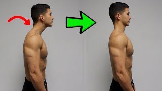 FIX Forward Head Posture Daily Corrective Routine [upl. by Holloway366]