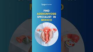 🔍 What is Adenomyosis 🔍Medical Tourism [upl. by Eirdua]