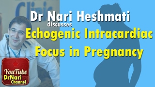 EICF Echogenic Intracardiac Focus on Ultrasound in Pregnancy Discussed by Dr Nari Heshmati [upl. by Susan]