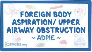 Foreign body aspiration  upper airway obstruction Nursing Process [upl. by Rutan]