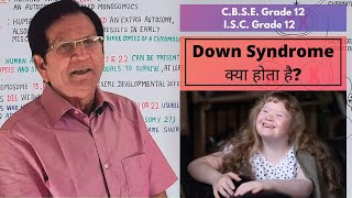 Down Syndrome  Grade 12 Biology [upl. by Okwu]