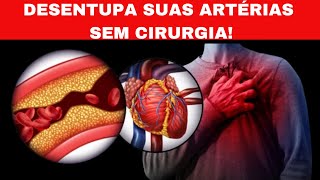 Desentupa Suas Artérias SEM CIRURGIA [upl. by Suollecram]