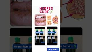 HERPES CURE herpes herpesvirus droffala hsv2 hsv1 hsv genitalherpes holistichealth herbs [upl. by Ariayek]