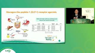 Latest Advances in MASLD Research  Prof Vincent Wong AASLD TLM23 [upl. by Stevana]