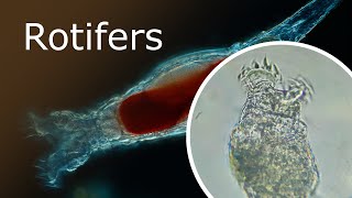 All About Rotifers Anatomy and Habitat Rotaria Macrura Under a Microscope 100x250x [upl. by Vine224]