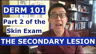 Derm 101 The Secondary Lesion Part 2 of a series on the physical exam in dermatology [upl. by Fabozzi382]