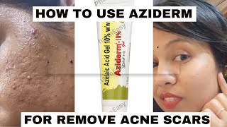 aziderm gel review honest reviewhow to use azelaic acid for acne amp acne marksacnetreatment viral [upl. by Martineau]