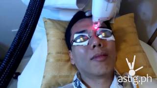 Luminisce Baby Skin Laser antiaging treatment [upl. by Ravel]