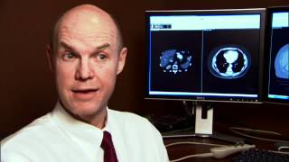 Understanding Radiology What is a Radiologist [upl. by Stefa]