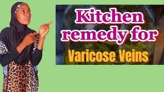 I Tried Natural Remedies for Varicose Veins selfcare [upl. by Annad]