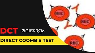 DCTDirect Coombs test മലയാളം [upl. by Enegue43]