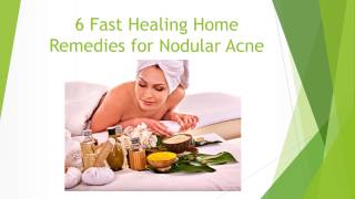 6 Fast Healing Home Remedies for Nodular Acne [upl. by Bertle]