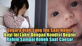 Gegara Sang Ibu Ngeyel Pengen Lahiran Di Tanggal Cantik Bayi Lahir Dengan Kondisi Begini [upl. by Reifinnej]