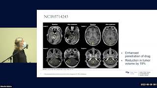 Overcoming the blood brain barrier in the management of CNS metastases  Mariza Daras MD [upl. by Namharludba653]