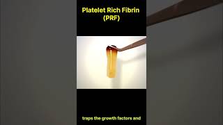 Platelet Rich Fibrin PRF  The New quotgold Standardquot For Wound Healing [upl. by Ulane234]