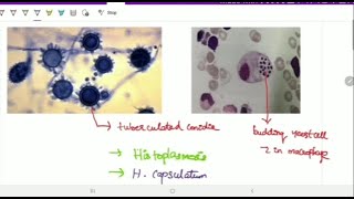 Systemic mycoses  Microbiology  Image based discussion [upl. by Ellwood]