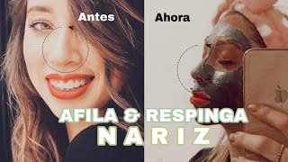 Afina y respinga tu nariz sin cirugía  Anderlyn Prado [upl. by Izak355]