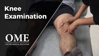 Knee Examination  Orthopaedics [upl. by Hrutkay]