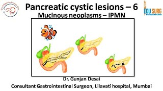 IPMN of the Pancreas  Intraductal papillary mucinous neoplasm  pancreatic cystic neoplasm part 6 [upl. by Eniamzaj]