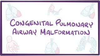 Congenital pulmonary airway malformation  an Osmosis preview [upl. by Iror]