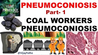 PNEUMOCONIOSIS Part 1 Pathogenesis Coal workers pneumoconiosis [upl. by Amis83]