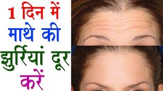 Remove Forehead Wrinkles and Make Face Young amp Fair  Wrinkle Free Forehead [upl. by Carolle]