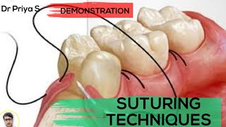 SUTURING TECHNIQUESDEMONSTRATION [upl. by Neelrac]