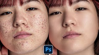 Face Retouching  Best Photoshop Tutorial  Skin Retouching 2023 [upl. by Alikahs323]