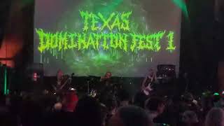 Epicardiectomy Live Haltom City TX 9282024 [upl. by Iatnahs]