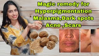 Take a challengeRemove malasma hyper pigmentation dark spots scars Acnenutmeg magic treatment [upl. by Lhadnek]