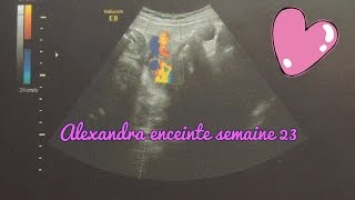 Alexandra enceinte  semaine 23 [upl. by Llehsar273]