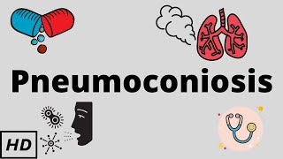 Pneumoconiosis Causes Signs and Symptoms Diagnosis and Treatment [upl. by Ordnasil]