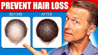 12 Proven Remedies to Prevent Hair Loss and Regrowth Regrow hair [upl. by Aisanat402]