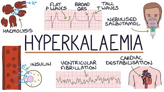 Understanding Hyperkalaemia High Potassium [upl. by Assirrak]