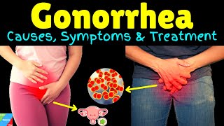 Gonorrhea – Symptoms Causes Pathophysiology Diagnosis Treatment Complications [upl. by Mavra299]