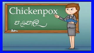 CHICKENPOX  How to care patient with chickenpox  පැපොල රෝගය ගැන දැනගමු sinhala [upl. by Lewiss]