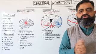 Stroke UrduHindi medium profmasoodfuzail Cerebral Infarction  Types of Stroke  Brain Stoke [upl. by Keisling]