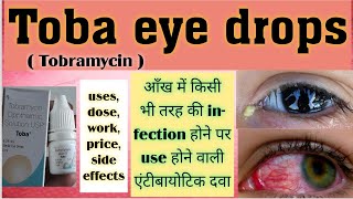 Toba eye drops in hindi  Tobramycin eye drops  usespriceside effectsdose  आँख में पाने की दवा [upl. by Cressy]