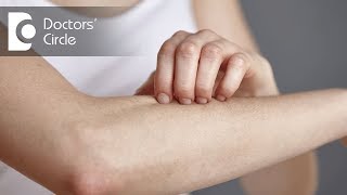 What causes rash on forearm and nose with its management  Dr Rashmi Ravindra [upl. by Goer413]