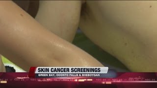 Free Skin Cancer Screenings [upl. by Nytsud]