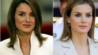 Transformación de Letizia antes y después todas las operaciones de la reina [upl. by Haon]