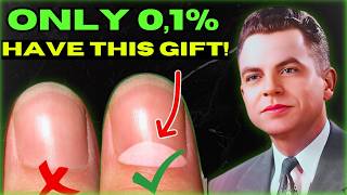 INCREDIBLE ✅ The Hidden Wealth Secret What the Half Moon on Your Thumbnail REALLY Means [upl. by Jarita]