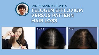 Differences Between Telogen Effluvium and Genetic Pattern Hair Loss [upl. by Madalyn]