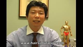 Hair StImulation and Acupuncture for hair loss 12  Hair Restoration  SMP [upl. by Ennaehr]