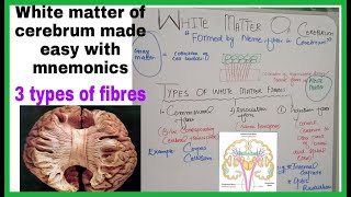 White Matter Of CerebrumTypes Of White matter Fibers CommissuralAssociation amp Projection Fibers [upl. by Llebyram647]