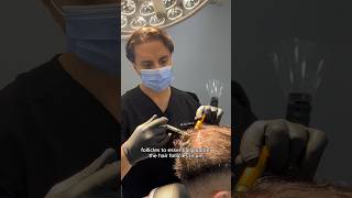 Prp Injection Treatment With Dr Solomon  Dr Medispa [upl. by Haynor]